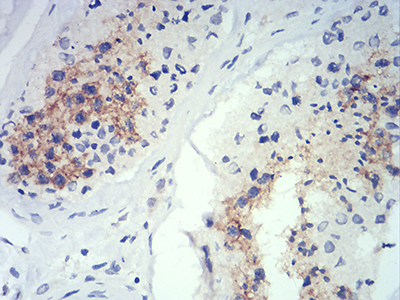 ATG14L Antibody