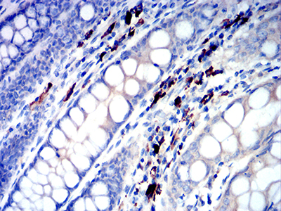 IGLC2 Antibody