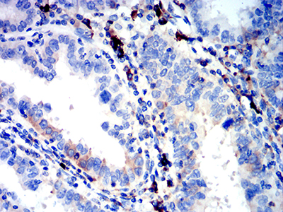 IGLC2 Antibody