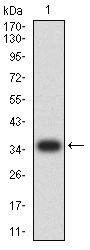 IGLC2 Antibody