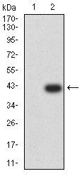 IGLC2 Antibody