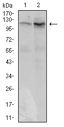 DIS3L2 Antibody