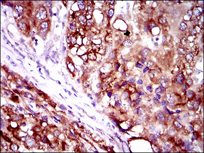 FATP2 Antibody