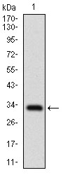 FATP2 Antibody