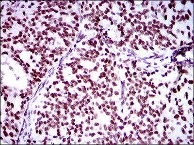 Ring1 Antibody