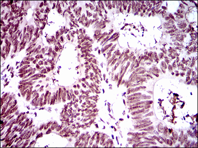 Ring1 Antibody