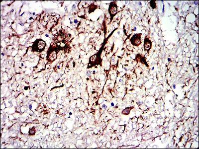 TUBA8 Antibody