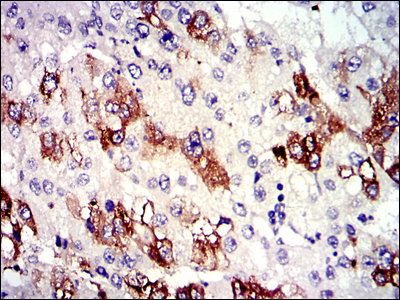 TUBA8 Antibody