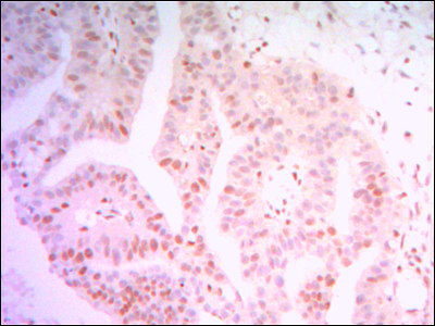 THAP11 Antibody