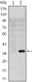 SLC22A1 Antibody