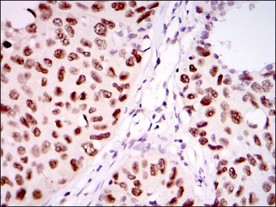 PSIP1 Antibody