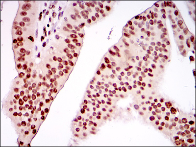 PSIP1 Antibody