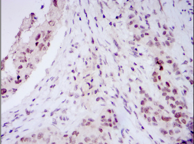 NACC1 Antibody