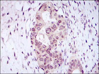 NACC1 Antibody