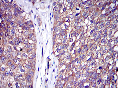 C-CBL Antibody