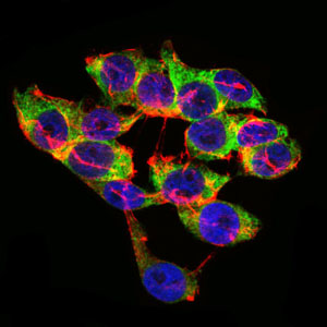 LPA Antibody