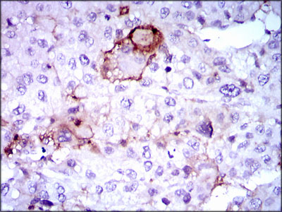 LPA Antibody