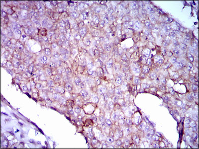 LPA Antibody