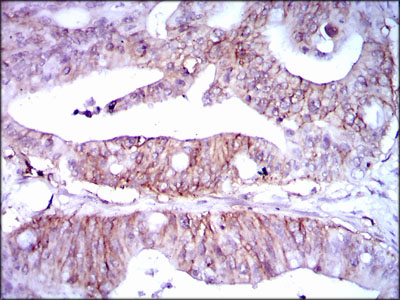 LPA Antibody