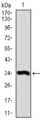 LPA Antibody