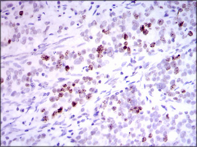 INCENP Antibody