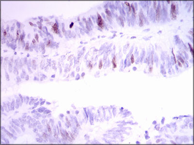 INCENP Antibody