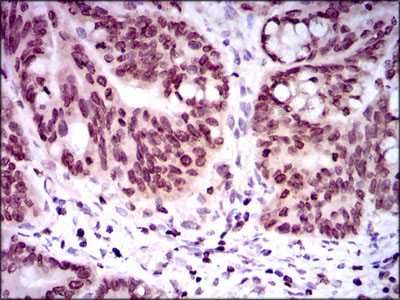 GCNF Antibody