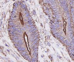 Beta-Actin Antibody