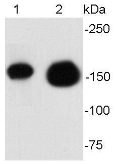 HER2 / ErbB2 Antibody