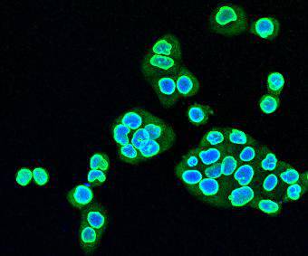 LMNB2 Antibody