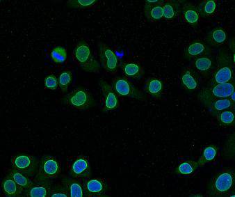 LMNB2 Antibody