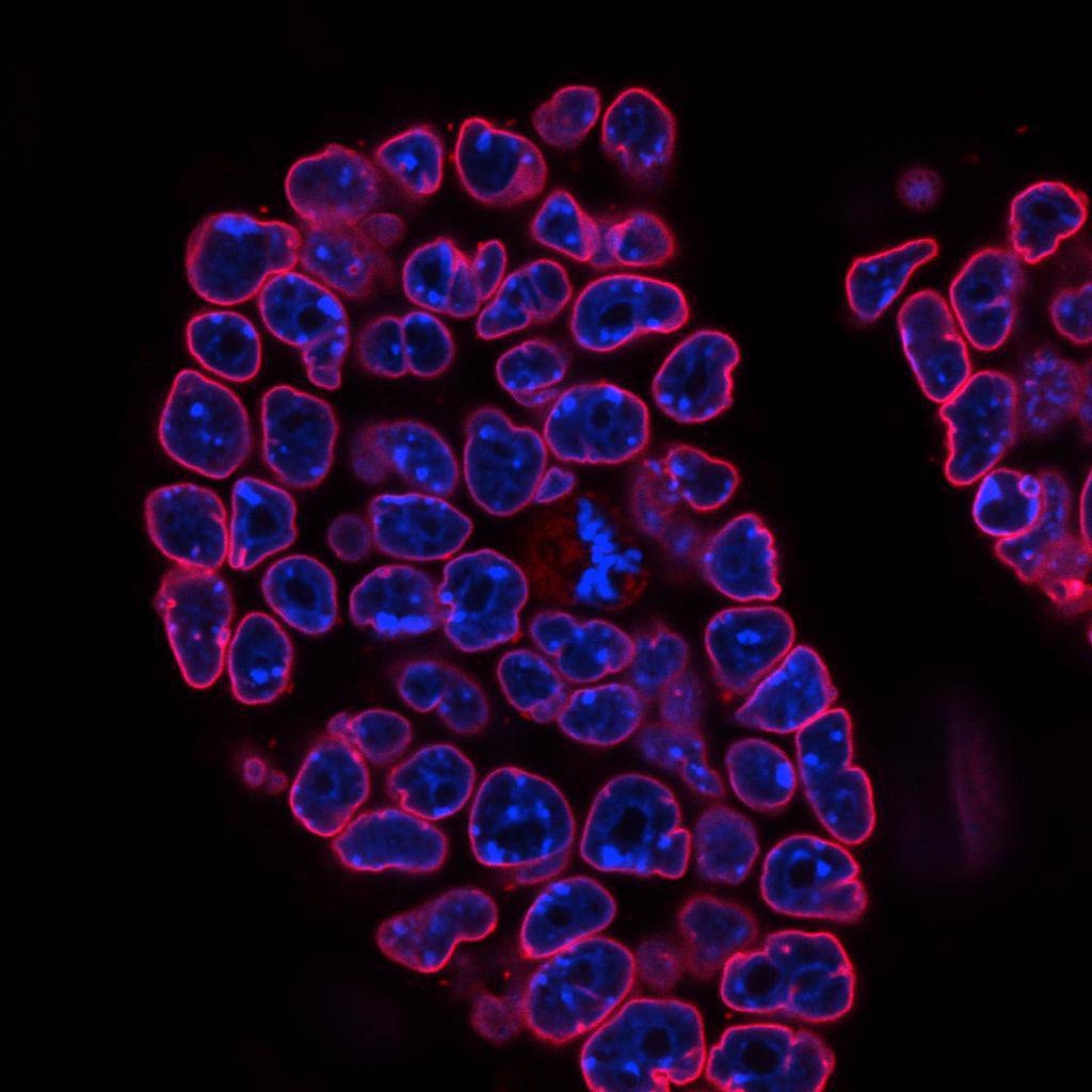 LMNB2 Antibody