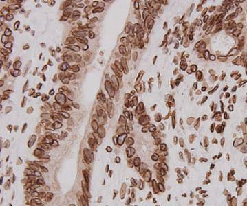 LMNB2 Antibody