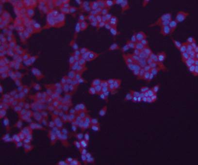 N-Cadherin Antibody