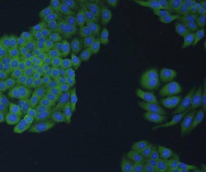 N-Cadherin Antibody