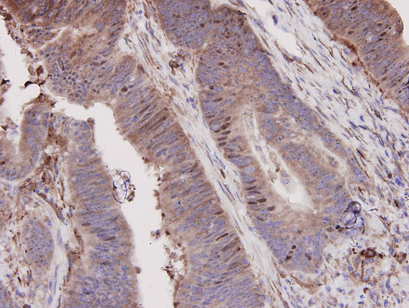 N-Cadherin Antibody