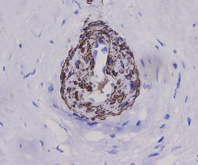 Alpha smooth muscle Actin Antibody