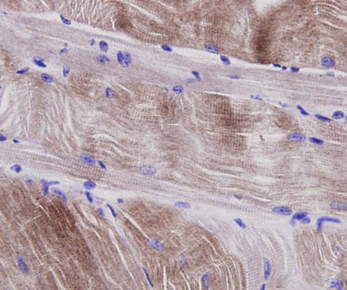 Alpha smooth muscle Actin Antibody