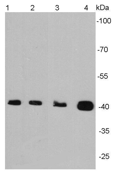 Alpha smooth muscle Actin Antibody