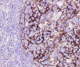 ICAM1 Antibody