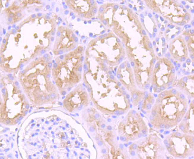 Dysferlin (DYSF) Antibody