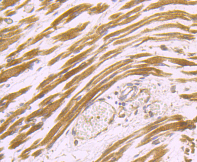 Dysferlin (DYSF) Antibody