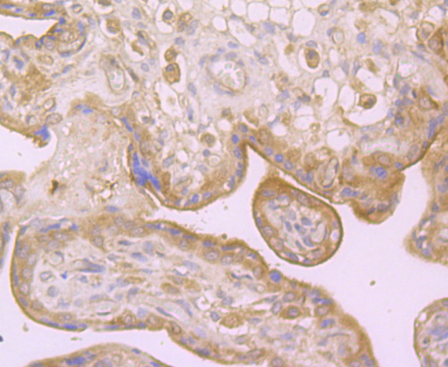 Dysferlin (DYSF) Antibody