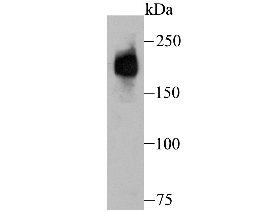 Dysferlin (DYSF) Antibody