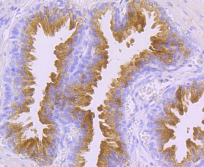 Prostate-Specific Antigen (PSA) Antibody