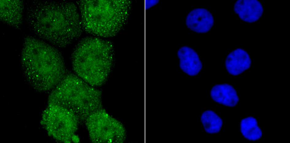 PKA C alpha Antibody