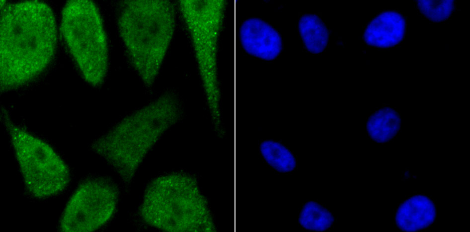 PKA C alpha Antibody