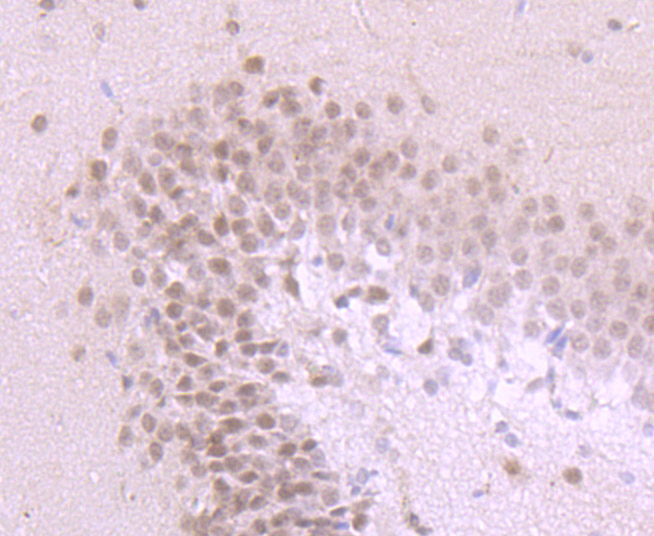 PKA C alpha Antibody