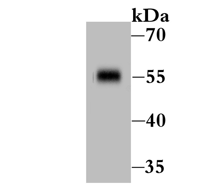 IL-7R-alpha Antibody