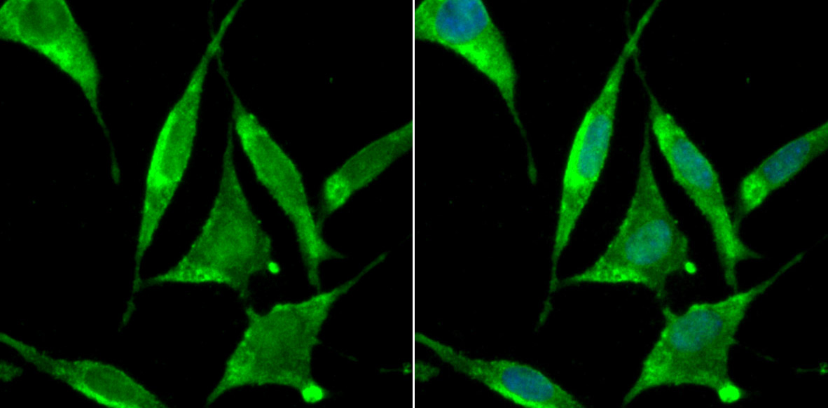 ZBTB48 Antibody